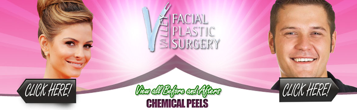 Facial Plastic Surgery | Chemical Peels
