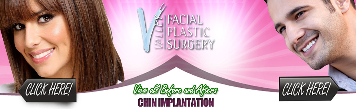 Chin Implantation Procedure