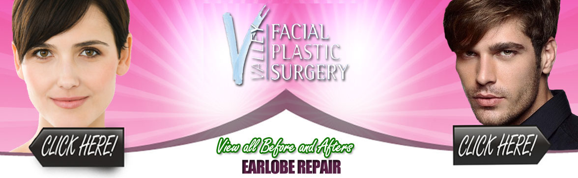 Ear Lobe Repair | Facial Plastic Surgery