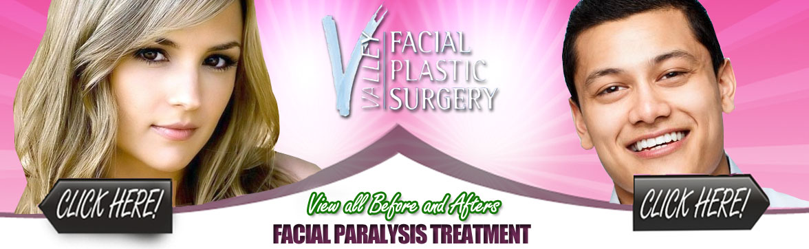 Facial Paralysis Treatment | Facial Plastic Surgery