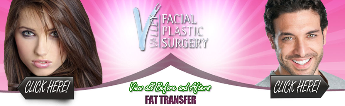 Fat Transfer Plastic Surgery