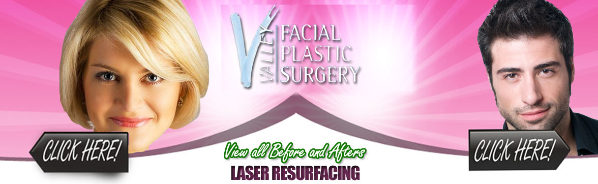 Laser Resurfacing | Arizona Plastic Surgery