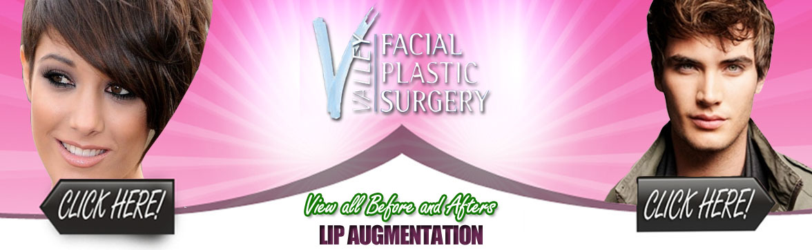 Lip Augmentation | Scottsdale Arizona Plastic Surgery