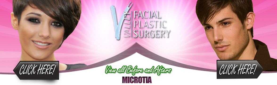 Microtia | Plastic Surgeon