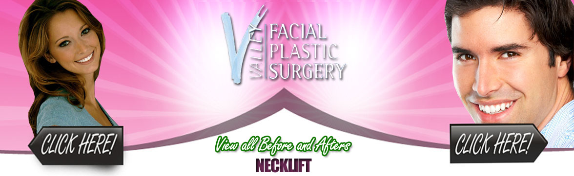Neck Lift | Arizona Plastic Surgery