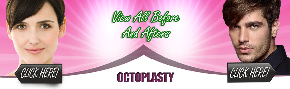 Otoplasty | Phoenix Arizona Plastic Surgery