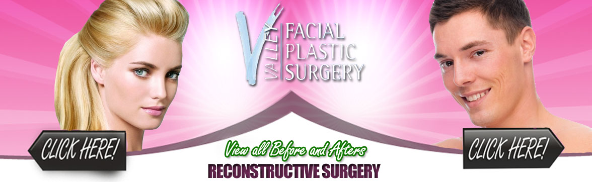 Reconstructive Plastic Surgery in Arizona